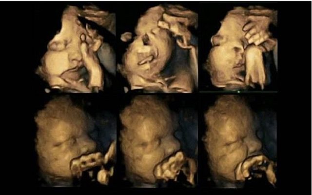 4d scan, grimace, foetus, smoke, cigarette, smoking