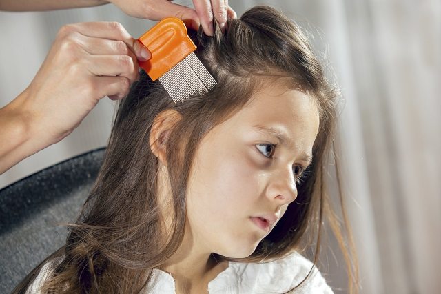 headl ice, removing head lice, tips for removing head lice, how to get rid of head lice,