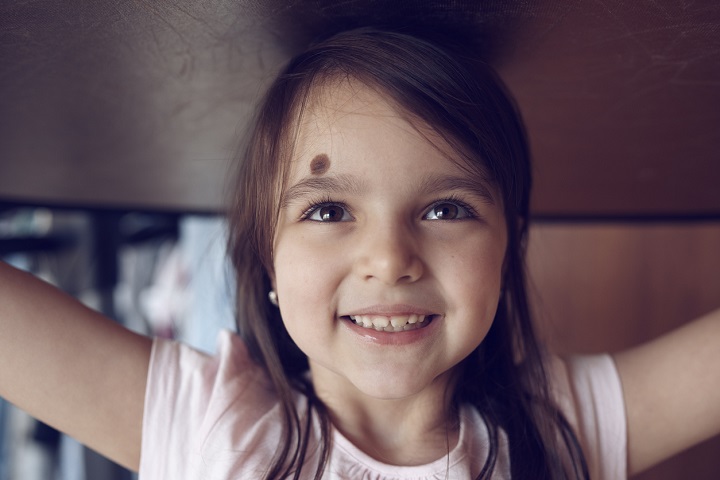 cute little girl looking up, smiling and having playful attitude.brown hair and hazel eyes.happiness and enjoyment feelings. birthmarks